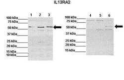 Invitrogen IL13RA2 Polyclonal Antibody 100 &mu;L; Unconjugated:Anticuerpos
