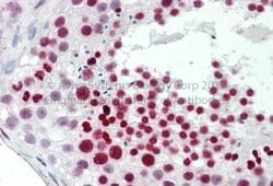 Invitrogen TNP1 Polyclonal Antibody 100 &mu;L; Unconjugated:Antibodies,