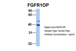 Invitrogen FGFR1OP Polyclonal Antibody 100 &mu;L; Unconjugated:Antibodies,