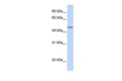 Invitrogen TBL2 Polyclonal Antibody 100 &mu;L | Buy Online | Invitrogen&trade; | Fisher Scientific