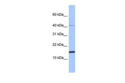 Invitrogen SPAG11B Polyclonal Antibody 100 &mu;L; Unconjugated:Antibodies,