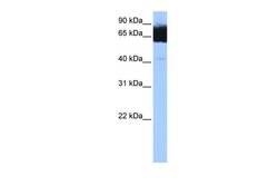 Invitrogen TTC12 Polyclonal Antibody 100 &mu;L; Unconjugated:Antibodies,