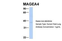 Invitrogen MAGEA4 Polyclonal Antibody 100 &mu;L; Unconjugated:Antibodies,