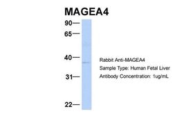 Invitrogen MAGEA4 Polyclonal Antibody 100 &mu;L; Unconjugated:Antibodies,