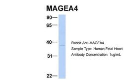 Invitrogen MAGEA4 Polyclonal Antibody 100 &mu;L; Unconjugated:Antibodies,