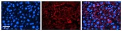 Invitrogen ICA1 Polyclonal Antibody 100 &mu;L; Unconjugated:Antibodies,
