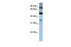 Invitrogen INPP5B Polyclonal Antibody 100 &mu;L; Unconjugated:Antibodies,