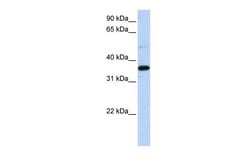 Invitrogen PTGR1 Polyclonal Antibody 100 &mu;L; Unconjugated:Antibodies,