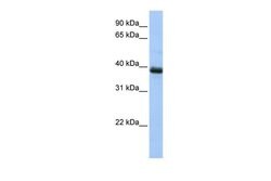 Invitrogen SPO11 Polyclonal Antibody 100 &mu;L; Unconjugated:Antibodies,