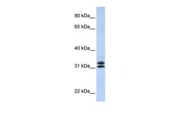 Invitrogen PYCR2 Polyclonal Antibody 100 &mu;L; Unconjugated:Antibodies,