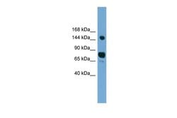 Invitrogen AGTPBP1 Polyclonal Antibody 100 &mu;L | Buy Online | Invitrogen&trade; | Fisher Scientific
