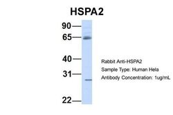 Invitrogen HSPA2 Polyclonal Antibody 100 &mu;L; Unconjugated:Antibodies,
