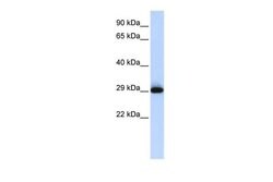 SUSD3 Polyclonal Antibody, Invitrogen&trade; 100 &mu;L; Unconjugated 