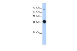 Invitrogen ATP6V0D2 Polyclonal Antibody 100 &mu;L; Unconjugated:Antibodies,
