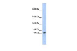 Invitrogen RPL30 Polyclonal Antibody 100 &mu;L | Buy Online | Invitrogen&trade; | Fisher Scientific