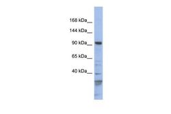 Invitrogen MYO1C Polyclonal Antibody 100 &mu;L; Unconjugated:Antibodies,
