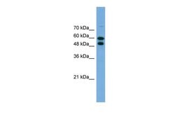 Invitrogen PGM1 Polyclonal Antibody 100 &mu;L; Unconjugated:Anticuerpos
