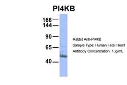 Invitrogen PI4KB Polyclonal Antibody 100 &mu;L; Unconjugated:Antibodies,