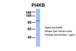 Invitrogen PI4KB Polyclonal Antibody 100 &mu;L; Unconjugated:Antibodies,