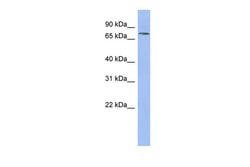 Invitrogen PNN Polyclonal Antibody 100 &mu;L; Unconjugated:Antibodies,