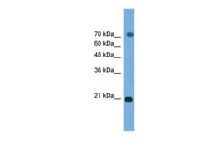 Invitrogen ERK3 Polyclonal Antibody 100 &mu;L; Unconjugated:Antibodies,