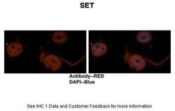 Invitrogen SET Polyclonal Antibody 100 &mu;L; Unconjugated:Antibodies,