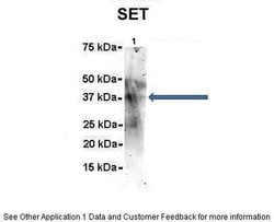 Invitrogen SET Polyclonal Antibody 100 &mu;L; Unconjugated:Antibodies,