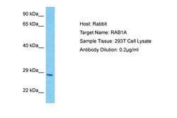 Invitrogen RAB1A Polyclonal Antibody 100 &mu;L; Unconjugated:Antibodies,