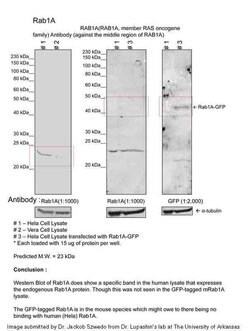 Invitrogen RAB1A Polyclonal Antibody 100 &mu;L; Unconjugated:Antibodies,