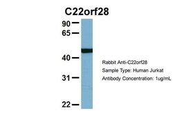 Invitrogen RTCB Polyclonal Antibody 100 &mu;L; Unconjugated:Antibodies,