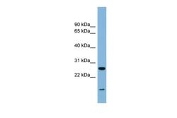 Invitrogen TRAPPC4 Polyclonal Antibody 100 &mu;L; Unconjugated:Antibodies,