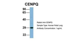 Invitrogen CENPQ Polyclonal Antibody 100 &mu;L; Unconjugated:Antibodies,