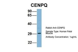 Invitrogen CENPQ Polyclonal Antibody 100 &mu;L; Unconjugated:Antibodies,