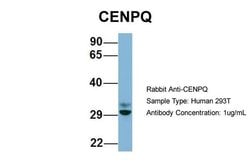 Invitrogen CENPQ Polyclonal Antibody 100 &mu;L; Unconjugated:Antibodies,