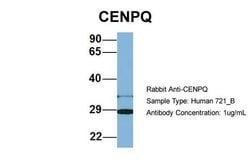 Invitrogen CENPQ Polyclonal Antibody 100 &mu;L; Unconjugated:Antibodies,