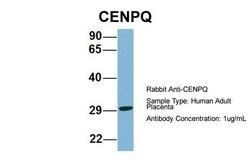 Invitrogen CENPQ Polyclonal Antibody 100 &mu;L; Unconjugated:Antibodies,