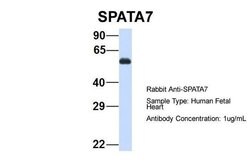 Invitrogen SPATA7 Polyclonal Antibody 100 &mu;L; Unconjugated:Antibodies,