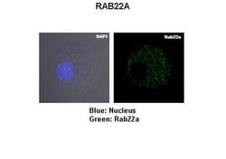 Invitrogen RAB22A Polyclonal Antibody 100 &mu;L; Unconjugated:Antibodies,