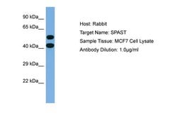 Invitrogen Spastin Polyclonal Antibody 100 &mu;L; Unconjugated:Antibodies,