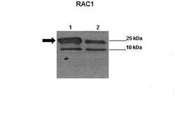Invitrogen RAC1 Polyclonal Antibody 100 &mu;L; Unconjugated:Antibodies,