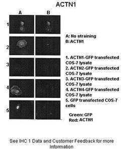 alpha Actinin 1 Polyclonal Antibody:Antibodies, Polyclonal