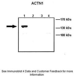 alpha Actinin 1 Polyclonal Antibody:Antibodies, Polyclonal