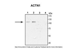 alpha Actinin 1 Polyclonal Antibody:Antibodies, Polyclonal
