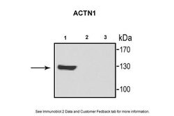 alpha Actinin 1 Polyclonal Antibody:Antibodies, Polyclonal