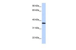 Invitrogen LCN12 Polyclonal Antibody 100 &mu;L; Unconjugated:Antibodies,