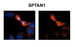 Invitrogen alpha-II Spectrin Polyclonal Antibody 100 &mu;L; Unconjugated:Antibodies,