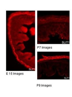 Invitrogen SLIT1 Polyclonal Antibody 100 &mu;L; Unconjugated:Antibodies,
