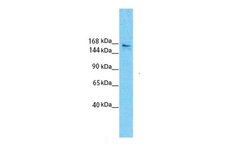 Invitrogen SLIT3 Polyclonal Antibody 100 &mu;L; Unconjugated:Antibodies,