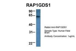 RAP1GDS1 Polyclonal Antibody:Antibodies, Polyclonal