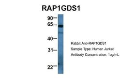 RAP1GDS1 Polyclonal Antibody:Antibodies, Polyclonal